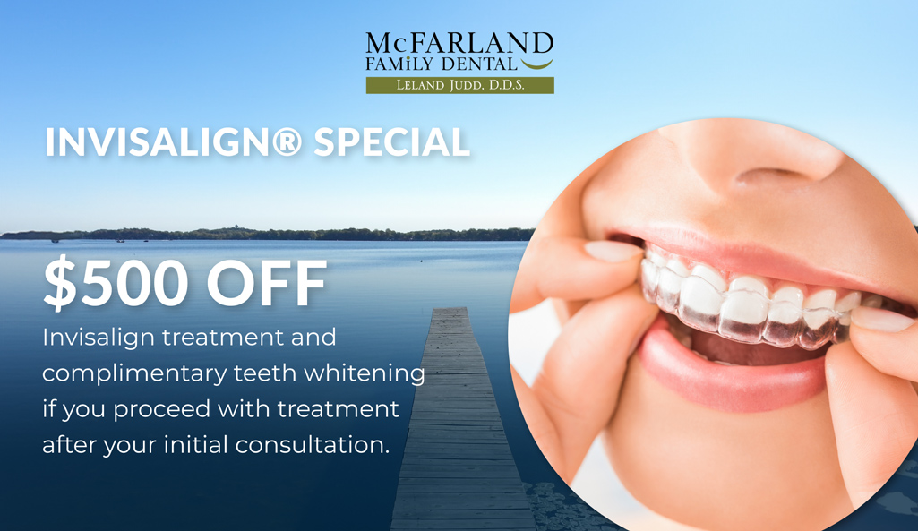 special offer